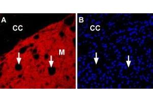 Expression of nAChRα6 in rat striatumImmunohistochemical staining of immersion-fixed, free floating rat brain frozen sections using Anti-Nicotinic Acetylcholine Receptor α6 (CHRNA6) (extracellular) Antibody (ABIN7581856), (1:100).