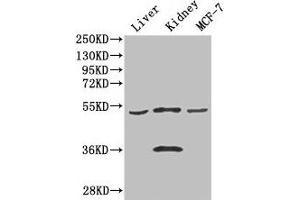 Western Blot Positive WB detected in: Mouse liver tissue, Mouse kidney tissue, MCF-7 whole cell lysate All lanes: CDSN antibody at 3 μg/mL Secondary Goat polyclonal to rabbit IgG at 1/50000 dilution Predicted band size: 52 kDa Observed band size: 52, 36 kDa (Corneodesmosin 抗体  (AA 40-229))