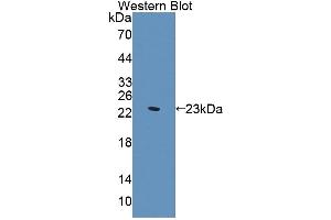 Detection of Recombinant SVIL, Human using Polyclonal Antibody to Supervillin (SVIL) (Supervillin 抗体  (AA 1385-1525))