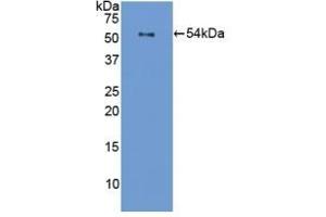 Detection of Recombinant FLG, Mouse using Polyclonal Antibody to Filaggrin (FLG) (Filaggrin 抗体  (AA 119-336))