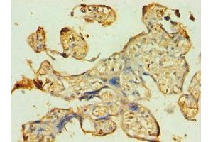 Immunohistochemistry of paraffin-embedded human placenta tissue using ABIN7145118 at dilution of 1:100 (ATG9B 抗体  (AA 715-924))