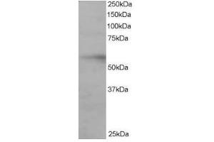 Image no. 1 for anti-Interferon Regulatory Factor 6 (IRF6) (C-Term) antibody (ABIN374199) (IRF6 抗体  (C-Term))