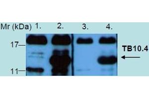 Western Blotting analysis of recombinant protein TB10. (Tb 10.4 抗体)