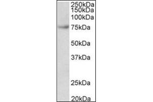 FUBP1 Antibody Cat. (FUBP1 抗体  (Internal Region))