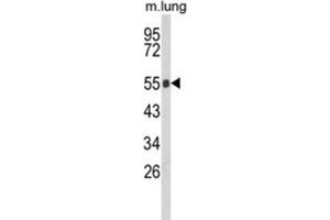 Western Blotting (WB) image for anti-Gc antibody (ABIN3003972) (Gc 抗体)