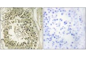 Immunohistochemistry analysis of paraffin-embedded human testis tissue, using HGS Antibody. (HGS 抗体  (AA 451-500))