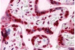 Human Placenta: Formalin-Fixed, Paraffin-Embedded (FFPE) (HMGB2 抗体  (AA 1-196))