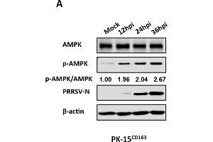 Western Blotting (WB) image for anti-Protein Kinase, AMP-Activated, alpha 1 Catalytic Subunit (PRKAA1) (AA 1-300) antibody (ABIN3021788)