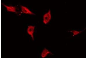 ABIN6266689 staining HuvEc by IF/ICC. (TP53I11 抗体  (N-Term))
