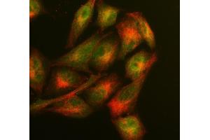 IF analysis of GLO1 using anti-GLO1 antibody (ABIN5692862) and anti-Tubulin Alpha antibody (ABIN7600339).