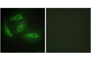 Immunofluorescence analysis of HeLa cells, using CDKL4 Antibody. (CDKL4 抗体  (AA 266-315))