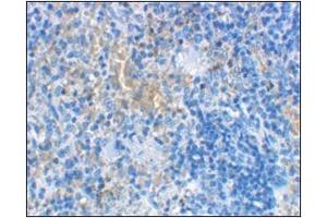 Immunohistochemical staining of rat spleen cells using AP30552PU-N at 2 μg/ml. (LY96 抗体  (Center))