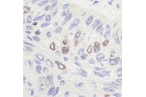 Immunohistochemistry (IHC) image for anti-Topo IIalpha (C-Term) antibody (ABIN7454588) (Topo IIalpha (C-Term) 抗体)