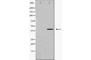Western blot analysis of GPR120 expression in PC12 cells,The lane on the left is treated with the antigen-specific peptide. (O3FAR1 抗体  (Internal Region))
