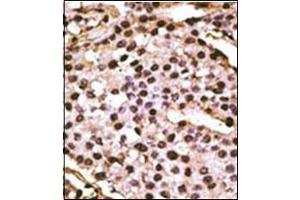 Immunohistochemistry (Paraffin-embedded Sections) (IHC (p)) image for anti-ATG9 Autophagy Related 9 Homolog A (S. Cerevisiae) (ATG9A) (AA 724-754), (C-Term) antibody (ABIN1449609)
