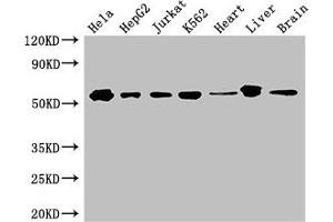 Western Blot Positive WB detected in: Hela whole cell lysate, HepG2 whole cell lysate, Jurkat whole cell lysate, K562 whole cell lysate, Mouse heart tissue, Mouse liver tissue, Mouse brain tissue All lanes: SMAD2 antibody at 3 μg/mL Secondary Goat polyclonal to rabbit IgG at 1/50000 dilution Predicted band size: 53, 49 kDa Observed band size: 53 kDa
