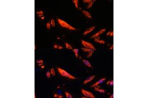 Immunofluorescence analysis of U-2 OS cells using LRRC7 antibody (ABIN6128203, ABIN6143347, ABIN6143348 and ABIN6216986) at dilution of 1:100. (LRRC7 抗体  (AA 730-890))