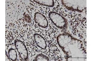 Immunostaining (ISt) image for anti-CD3e Molecule, epsilon Associated Protein (CD3EAP) (AA 2-110) antibody (ABIN524252)