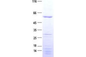 Western Blotting (WB) image for NUF2, NDC80 Kinetochore Complex Component (NUF2) protein (His tag) (ABIN2727781)