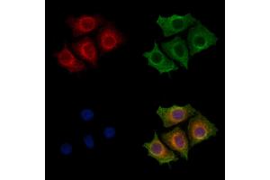 ABIN7094366 and ABIN7098413 staining HepG2 cells by IF/ICC.