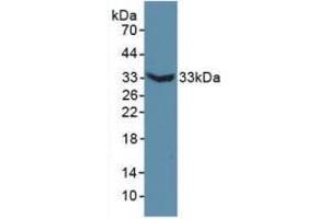 Western blot analysis of recombinant Mouse MAP6. (MAP6 抗体  (AA 177-387))