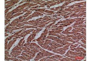 Immunohistochemistry (IHC) image for anti-Purinergic Receptor P2x, Ligand-Gated Ion Channel, 3 (P2RX3) (Internal Region) antibody (ABIN3187746)