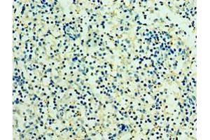 Immunohistochemistry of paraffin-embedded human spleen tissue using ABIN7166935 at dilution of 1:100 (RSPO1 抗体  (AA 21-263))