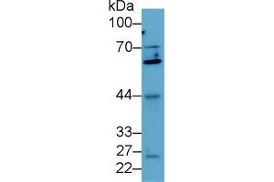 Western blot analysis of Human MCF7 cell lysate, using Mouse Smad4 Antibody (2 µg/ml) and HRP-conjugated Goat Anti-Rabbit antibody ( (SMAD4 抗体  (AA 9-231))