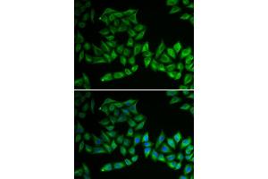 Immunofluorescence analysis of U2OS cells using TPMT antibody . (TPMT 抗体  (AA 1-245))