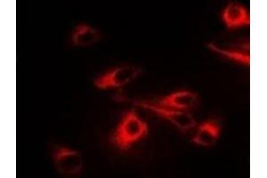 Immunofluorescent analysis of CCT2 staining in A549 cells. (CCT2 抗体)