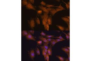 Immunofluorescence analysis of C6 cells using TSLP antibody (ABIN6128843, ABIN6149624, ABIN6149626 and ABIN6217014) at dilution of 1:100. (Thymic Stromal Lymphopoietin 抗体  (AA 29-159))