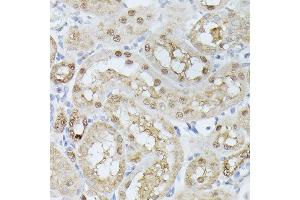 Immunohistochemistry of paraffin-embedded rat kidney using TPI1 antibody (ABIN7270977) at dilution of 1:100 (40x lens). (TPI1 抗体  (AA 1-249))