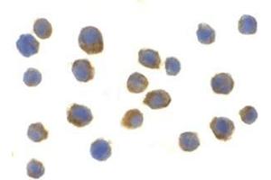 Immunocytochemistry of TLR9 in Jurkat cells with this product at 2 μg/ml. (TLR9 抗体  (Center))