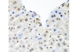 Immunohistochemistry of paraffin-embedded Mouse liver using TARDBP Polyclonal Antibody at dilution of 1:100 (40x lens).