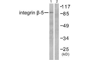 Western blot analysis of extracts from COS7 cells, using Integrin beta 5 antibody (ABIN5976431). (Integrin beta 5 抗体  (C-Term))