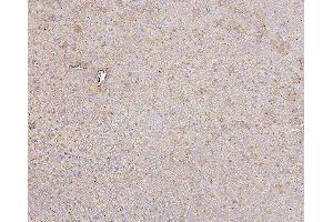 IHC analysis of HSPD1 using anti-HSPD1 antibody (ABIN7600976). (HSPD1 抗体  (AA 260-496))