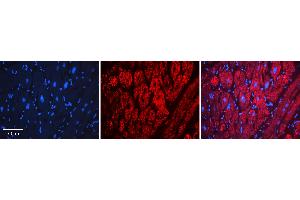 Rabbit Anti-LSS Antibody   Formalin Fixed Paraffin Embedded Tissue: Human heart Tissue Observed Staining: Cytoplasmic Primary Antibody Concentration: N/A Other Working Concentrations: 1:600 Secondary Antibody: Donkey anti-Rabbit-Cy3 Secondary Antibody Concentration: 1:200 Magnification: 20X Exposure Time: 0. (LSS 抗体  (Middle Region))