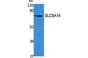 Slc6a14 抗体  (C-Term)