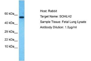 Host: Rabbit Target Name: SOHLH2 Sample Type: Fetal Lung lysates Antibody Dilution: 1. (SOHLH2 抗体  (N-Term))