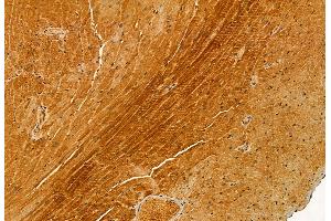 ABIN6265670 and ABIN6272889 at 1/100 staining Mouse heart tissue by IHC-P.