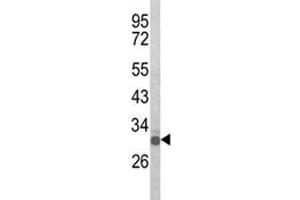 Western Blotting (WB) image for anti-Oligodendrocyte Transcription Factor 3 (OLIG3) (AA 74-100) antibody (ABIN3028898)