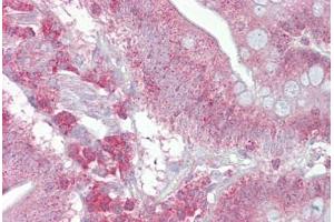 Anti-PSEN1 / Presenilin 1 antibody IHC staining of human small intestine. (Presenilin 1 抗体  (AA 300-349))