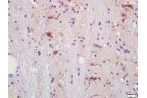 Formalin-fixed and paraffin embedded mouse brain labeled with Anti-IL-17RC Polyclonal Antibody, Unconjugated  at 1:200 followed by conjugation to the secondary antibody and DAB staining.