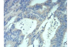 Immunohistochemistry (IHC) image for anti-Methyl CpG Binding Protein 2 (MECP2) (AA 7-148) antibody (ABIN5889789) (MECP2 抗体  (AA 7-148))