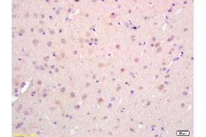 Formalin-fixed and paraffin embedded rat brain labeled with Rabbit Anti EphA2/Eph receptor A2 Polyclonal Antibody, Unconjugated (ABIN669201) at 1:200 followed by conjugation to the secondary antibody and DAB staining (EPH Receptor A2 抗体  (AA 901-976))