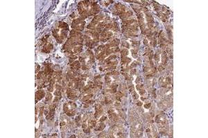 Immunohistochemical staining of human stomach with SCAF1 polyclonal antibody  shows strong cytiplasmic positivity in glandular cells at 1:50-1:200 dilution. (SCAF1 抗体)