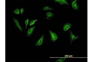 Immunofluorescence of monoclonal antibody to RPS6KB1 on HeLa cell.