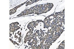 IHC analysis of TOMM70 using anti-TOMM70 antibody (ABIN7599855). (TOM70 抗体  (AA 122-608))