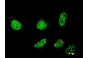 Immunofluorescence of monoclonal antibody to CSDC2 on HeLa cell.