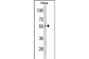 Western blot analysis of DFNA5 Antibody in Hela cell line lysates (35ug/lane) (DFNA5 抗体  (N-Term))
